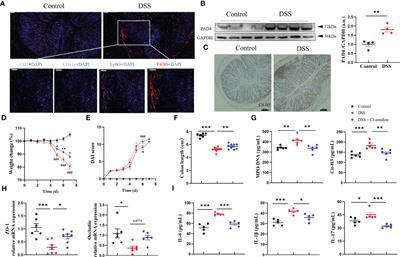 The role of protein arginine deiminase 4-dependent neutrophil extracellular traps formation in ulcerative colitis